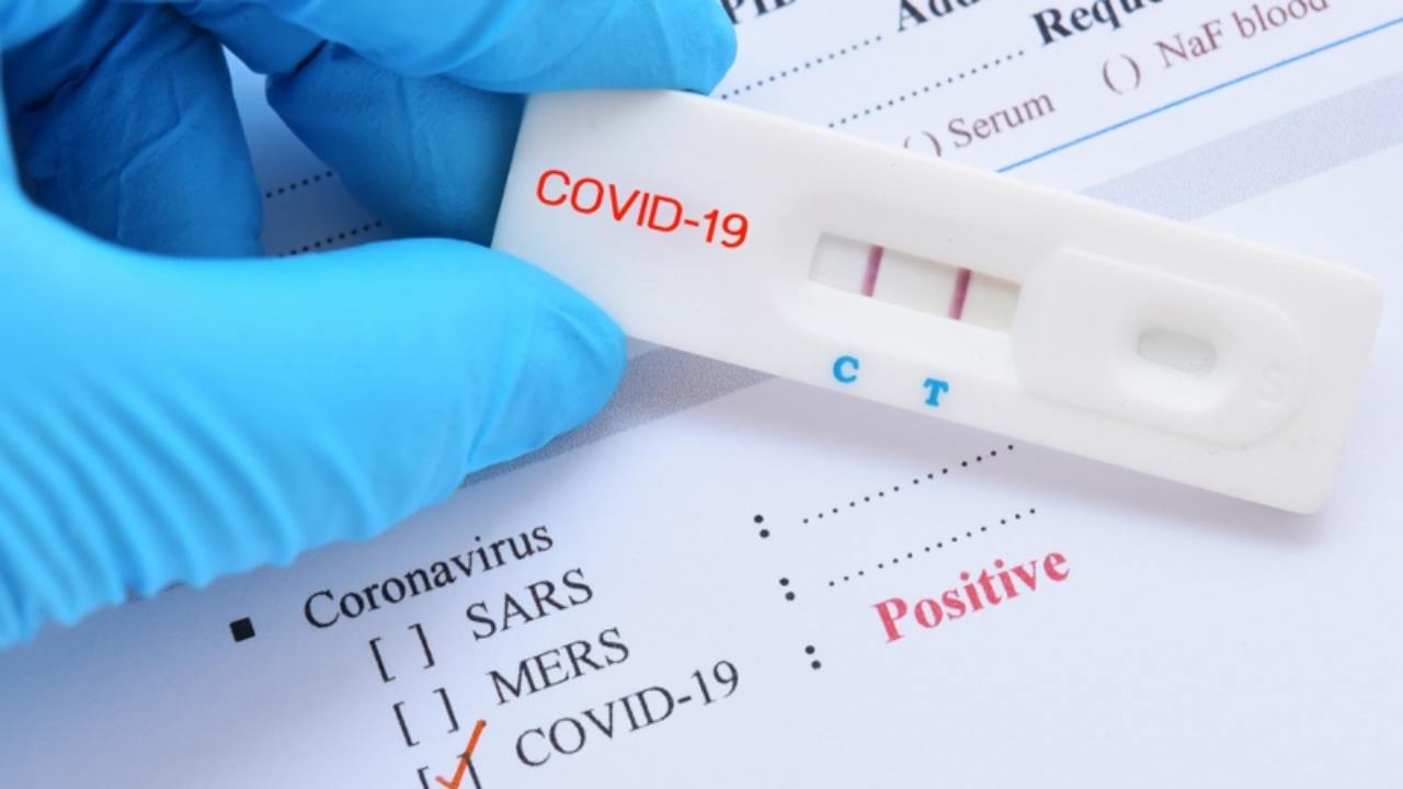 Covid, non solo tamponi. In arrivo in farmacia i test fai da te