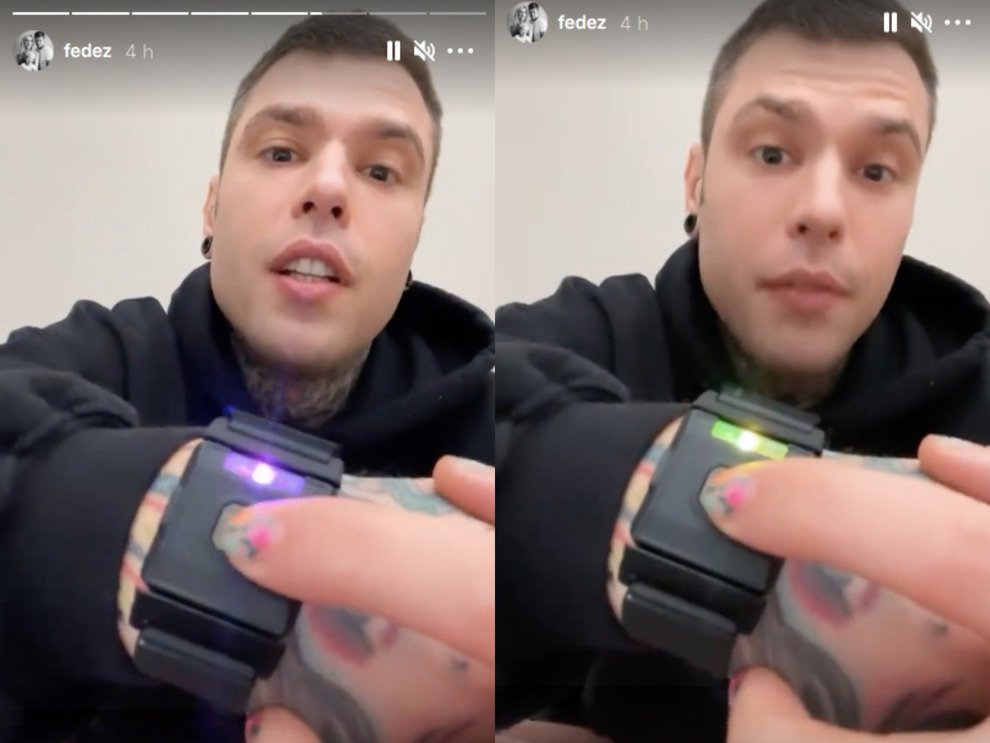 Fedez braccialetti
